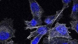 Células de cáncer de próstata