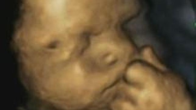 Asi Es La Cara De Un Bebe En El Utero Cuando Nota A Su Madre Estresada