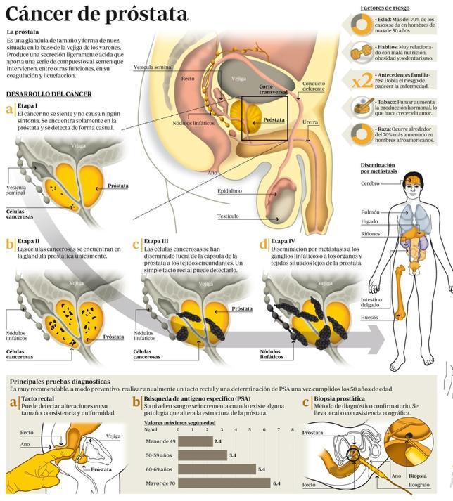 Cancer de colon etapas y sintomas Hepatic cancer and itching