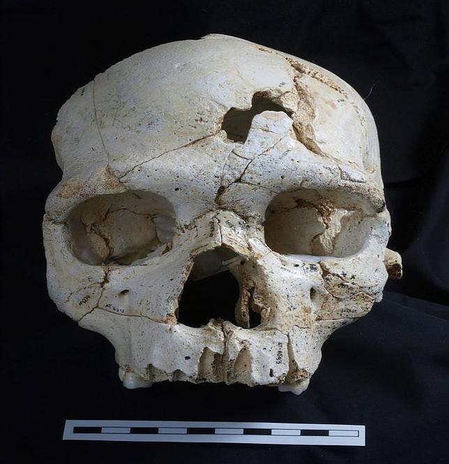 Vista frontal del Cráneo 17 de la Sima de los Huesos, con los dos impactos que causaron la muerte del individuo