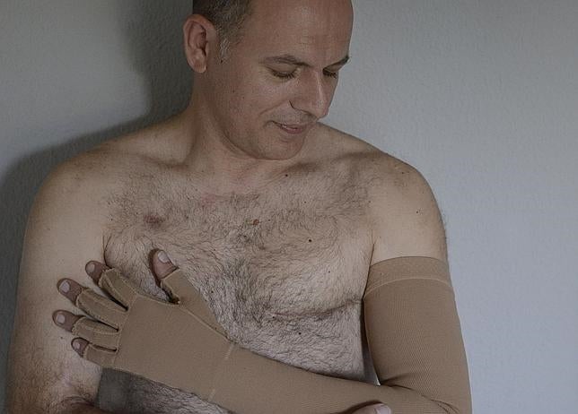 Pedro Márquez, operado de cancer de mama, posa para ABC