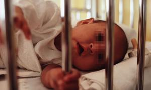 Un 12% de los lactantes sufre deformidades del cráneo por malas posturas de descanso