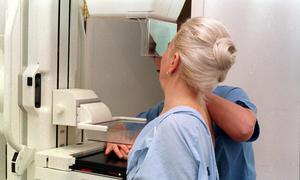 La mortalidad del cáncer de mama baja en España pese al aumento de los casos
