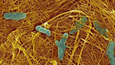«Dentro de 20 años las bacterias eliminarán nuestros residuos»