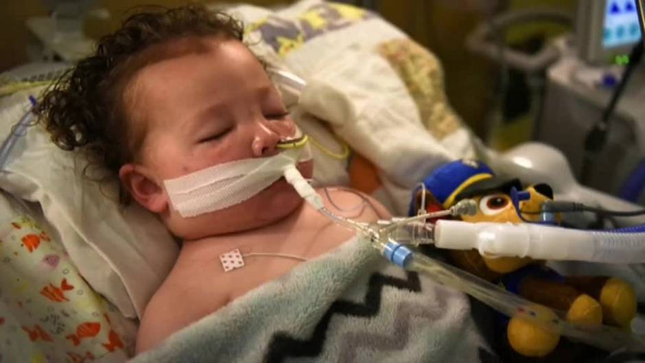 Un Bebe De Dos Anos Intubado Con Neumonia Tras Contraer La Covid 19