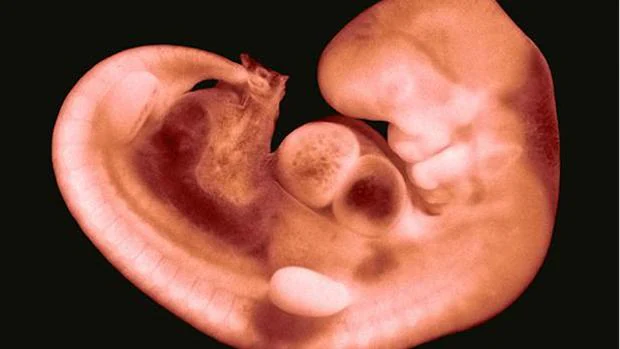 Un embrión humano de 30 días