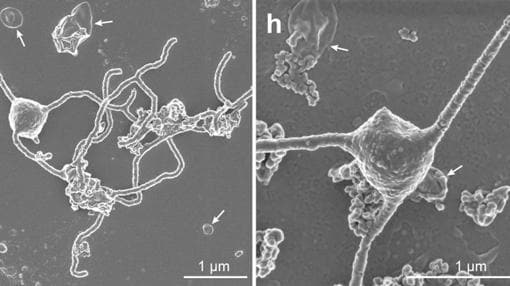 Fotografías de «Prometheoarchaeum syntrophicum», un microorganismo clave en la historia de todos los eucariotas
