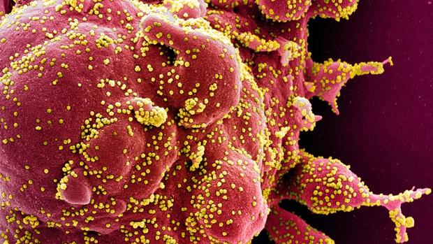 El virus SARS-CoV-2, responsable de la Covid-19