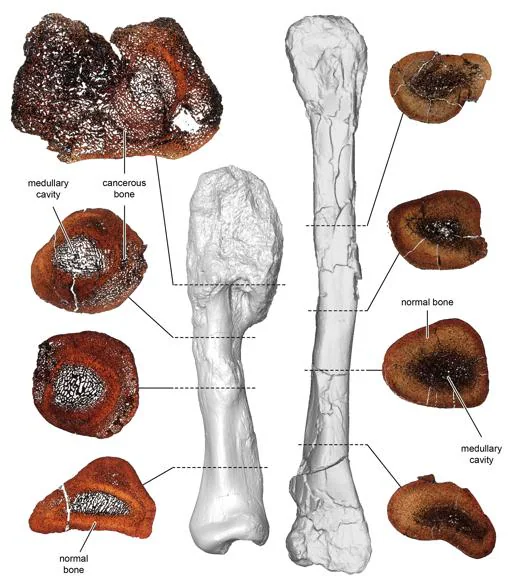 Comparación entre secciones delgadas de la espinilla cancerosa (izquierda) y la espinilla normal del dinosaurio cornudo Centrosaurus apertus. Los fósiles fueron seccionados delgados para comparar la microestructura ósea y diagnosticar adecuadamente el osteosarcoma