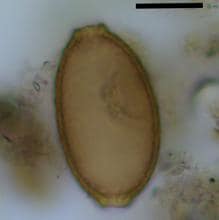 Microscopic fish tapeworm egg found in dog coprolite.  Black scale bar represents 20 micrometers