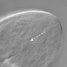 Microscope image of the posterior end of a mite anus