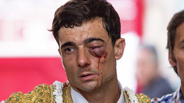 La sangre cae por el rostro de Paco Ureña, con el ojo amoratado y cerrado