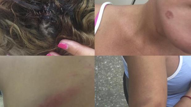 Fotografías facilitadas por el Observatorio contra la LGBTfobia, de las agresiones sufridas por una transexual en un polígono de la capital malagueña