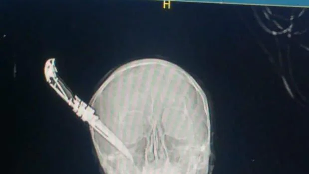 Un joven clava un cuchillo en la cabeza a un hombre de 60 años que quería evitar el robo de una bici en Guecho Cuchillo-el-correo-U01107565148cAg-620x349@abc