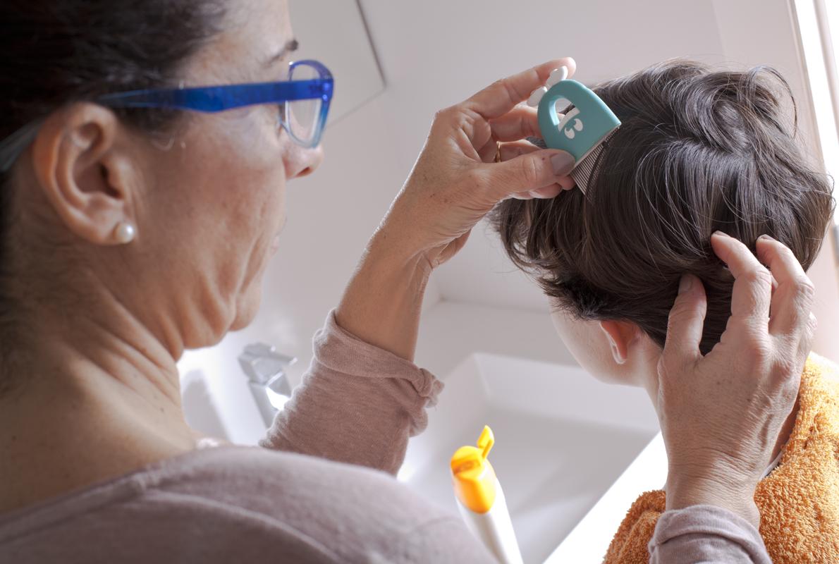 puede tener liendres sin piojos puede tener liendres sin piojos