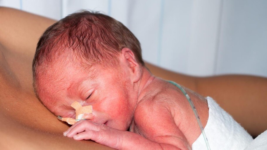 La Vida De Los Bebes Prematuros Cuando Reciben El Alta Hospitalaria