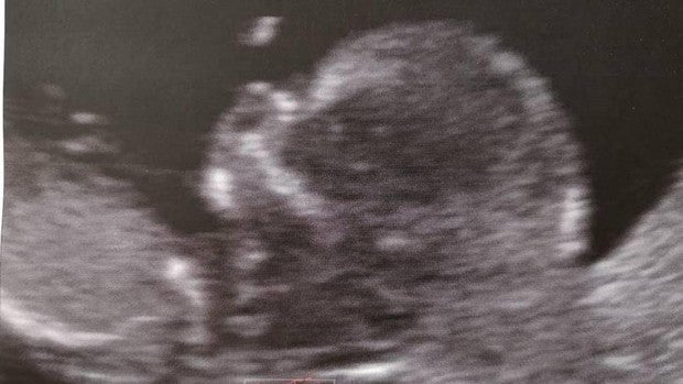 Embarazo Semana A Asemana Asi Es Tu Bebe En La Semana 12 De Embarazo