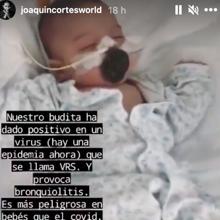 El Bebe De Joaquin Cortes Muy Grave En El Hospital Tiene Un Virus Mas Agresivo Que El Covid