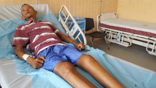 El recluso Alejandro Manuel Mago Coraspe, en el hospital tras haberse comido una rata en prisión