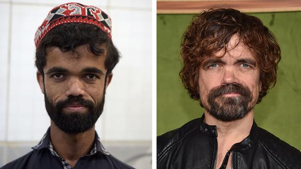 Rozi Khan y Peter Dinklage, que interpreta a Tyrion Lannister en «Juego de Tronos»