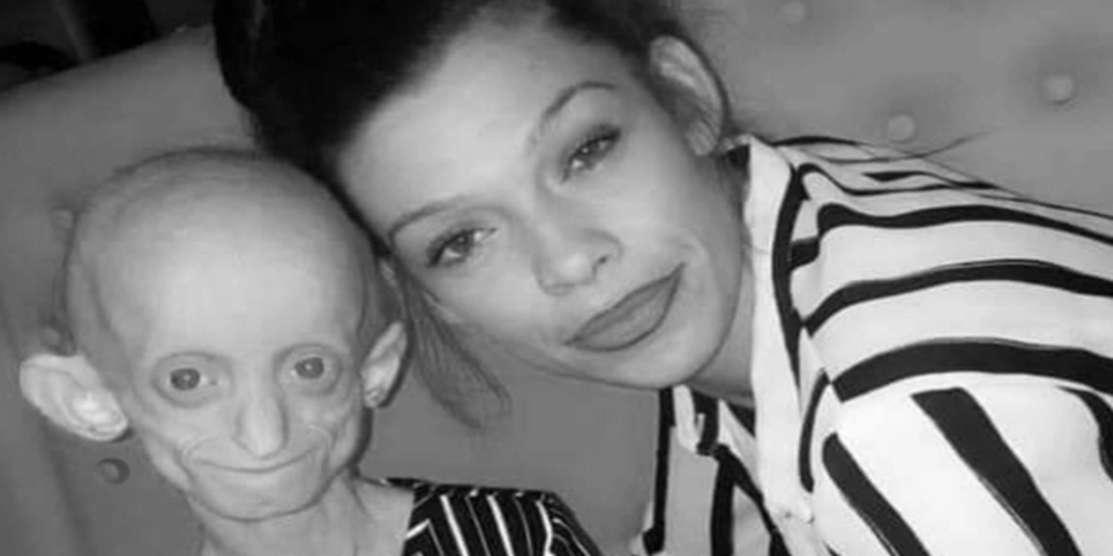 Historia De Benjamin Button Es Real