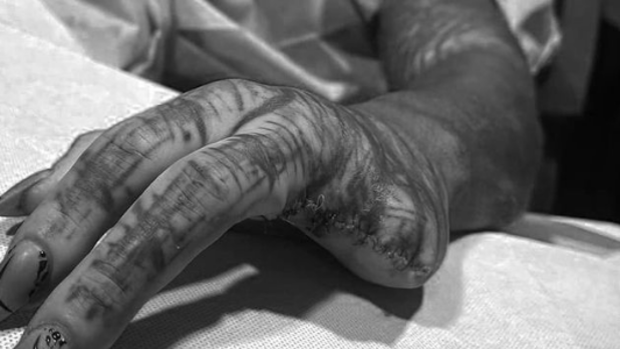 dedos-hombre-alien-kDHE--620x349@abc