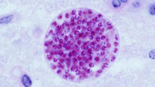 que produce toxoplasmosis en el embarazo