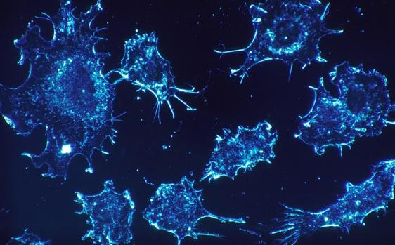 Células cancerígenas