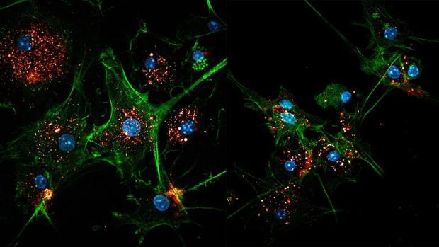 Células dendríticas (en verde) con EVIR capturando antígenos tumorales de los exosomas (en rojo y dorado)