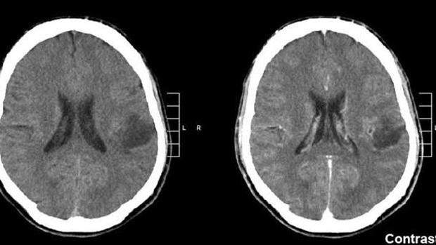 Resonancia que cerebral es magnetica