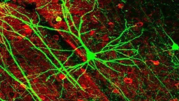 Neuronas