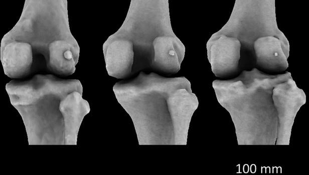 Dolor en el centro de la rodilla