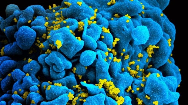 Virus del sida