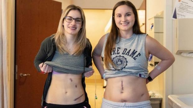 Las hermanas, tras la mediática operación