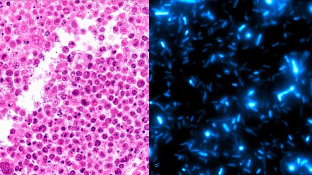 Imagen histológica de bacterias que crecen en regiones necróticas de tumores de linfoma (IZQUIERDA). Las bacterias están programadas para sufrir oleadas de crecimiento y autodestrucción que conducen a la liberación inmunoterapéutica (DERECHA).