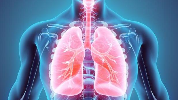 Identifican un nuevo tipo de cáncer de pulmón muy agresivo que no afecta a fumadores