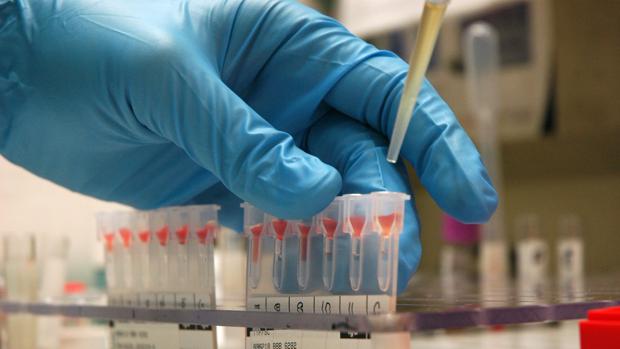 Un test detcta el cáncer de pulmón cuando es tratable