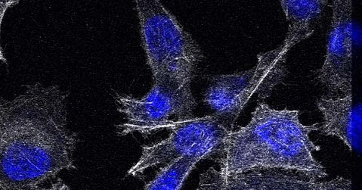 estrategias de cuidado de pc de cáncer de próstata