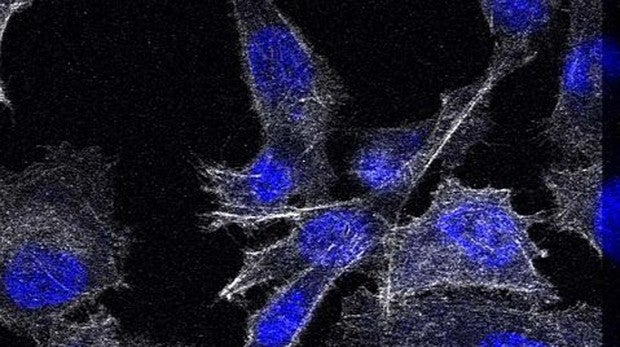 cáncer de próstata metastásico últimas noticias