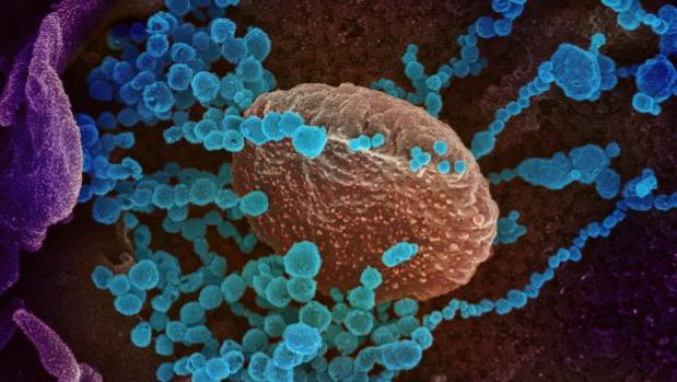 PharmaMar anuncia que su tratamiento contra el coronavirus está listo para probarse en pacientes
