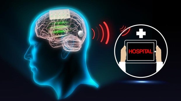 Simulación de cómo sería el implante aplicado a un ser humano