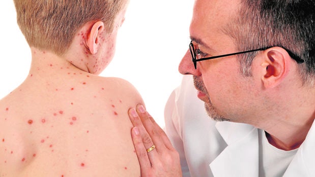 Médico mirando a un niño con sarampión
