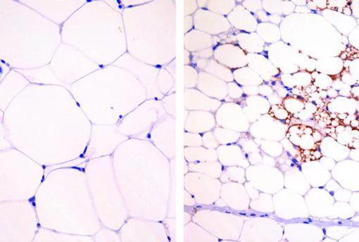 Adipocitos de un ratón obeso sin tratar con digoxina (izda) y , la derecha, tratados